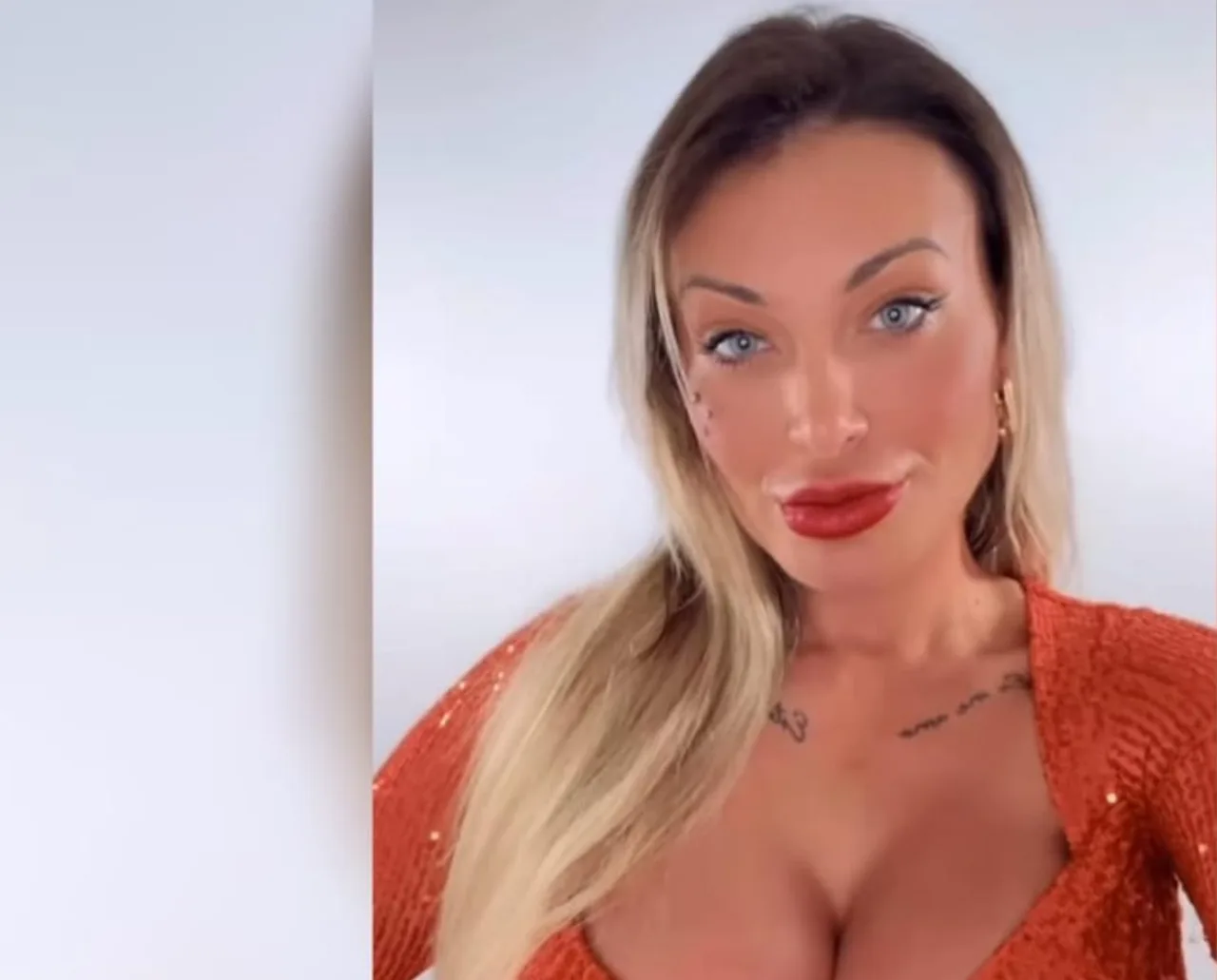 Andressa Urach mostra antes e depois com Deep Plane e Fox Eyes